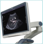 http://www.toshiba-medical.eu/upload/TMSE_ULTRASOUND/Xario%20XG/System%20images/XarioXG_LM2_3.jpg?epslanguage=en